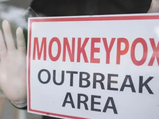 monkeypox virus outbreak area