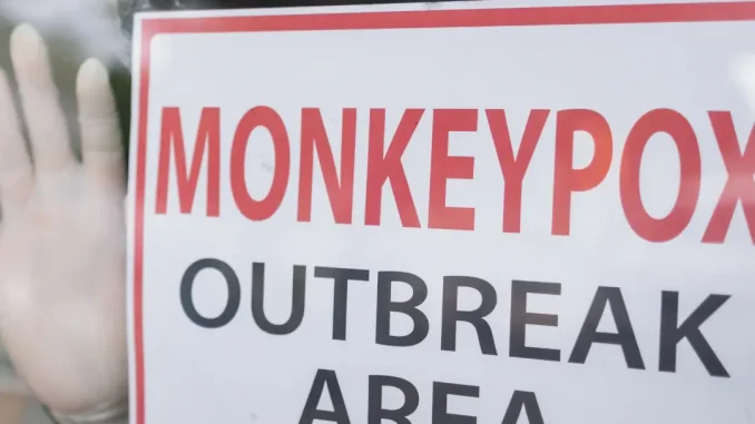 monkeypox virus outbreak area