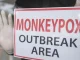 monkeypox virus outbreak area